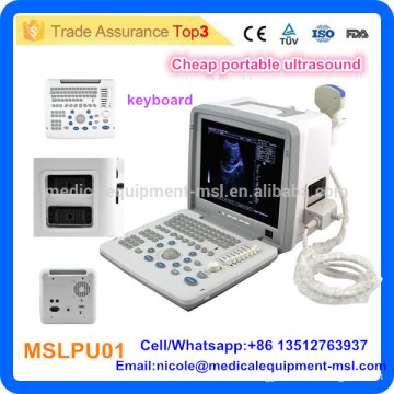 MSLPU01-I Cheapest hospital Equipment laptop ultrasound machine/portable ultrasound scanner